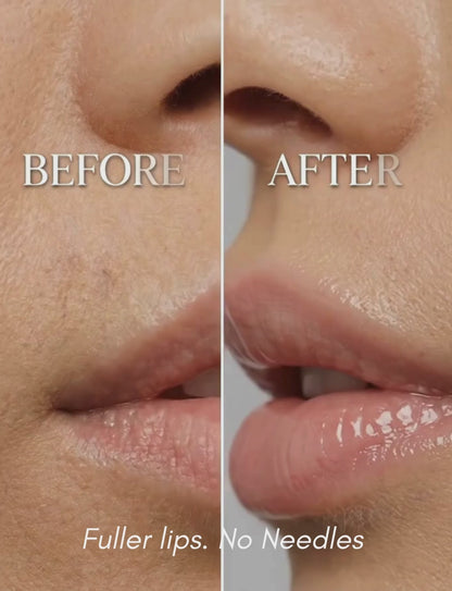 VENEXA 2.0 Set— Instant Volume Enhancer Balms